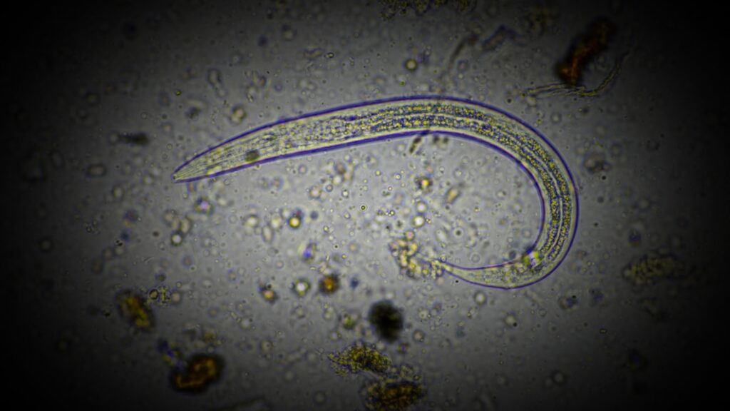 A parasite under a microscope. 