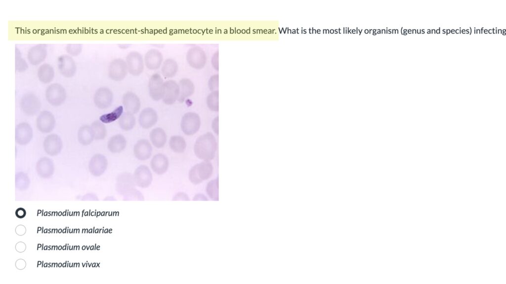An example of an assessment with a question about the image of a crescent-shaped gametocyte in a blood smear.